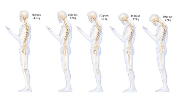 Dor cervical